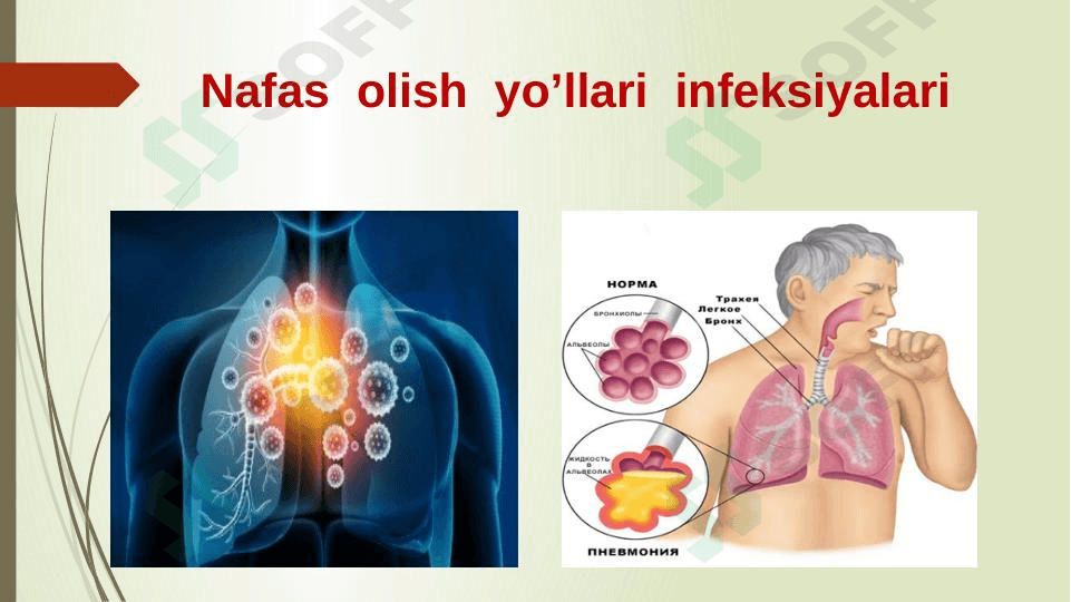 Nafas olish organlarining kasalliklari . 1