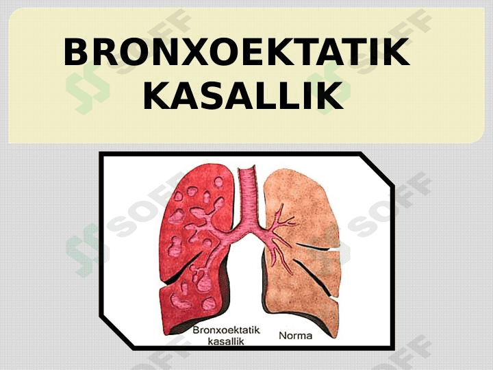 BRONXOEKTATIK KASALLIK 1