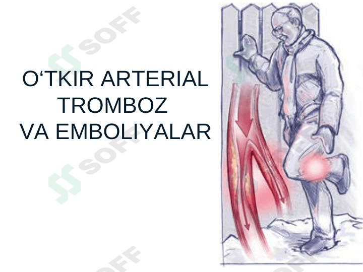 O‘TKIR ARTERIAL,TROMBOZ VA EMBOLIYALAR 1