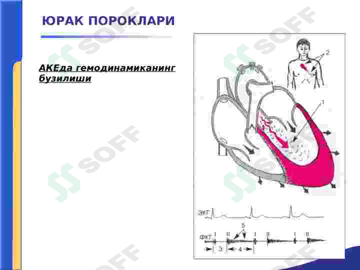 YURAK PAROKLARI.AORTA KLAPANINI YETISHMOVCHILIGI 3