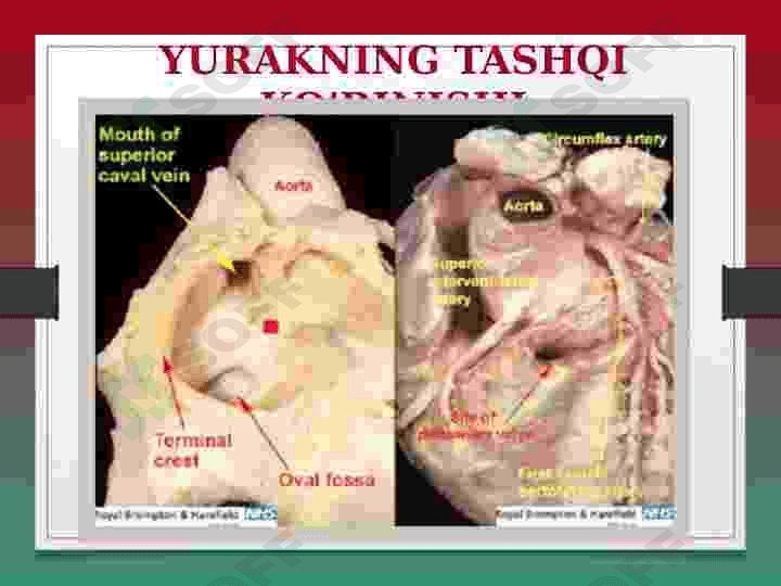 YURAK ANATOMIYASI 3