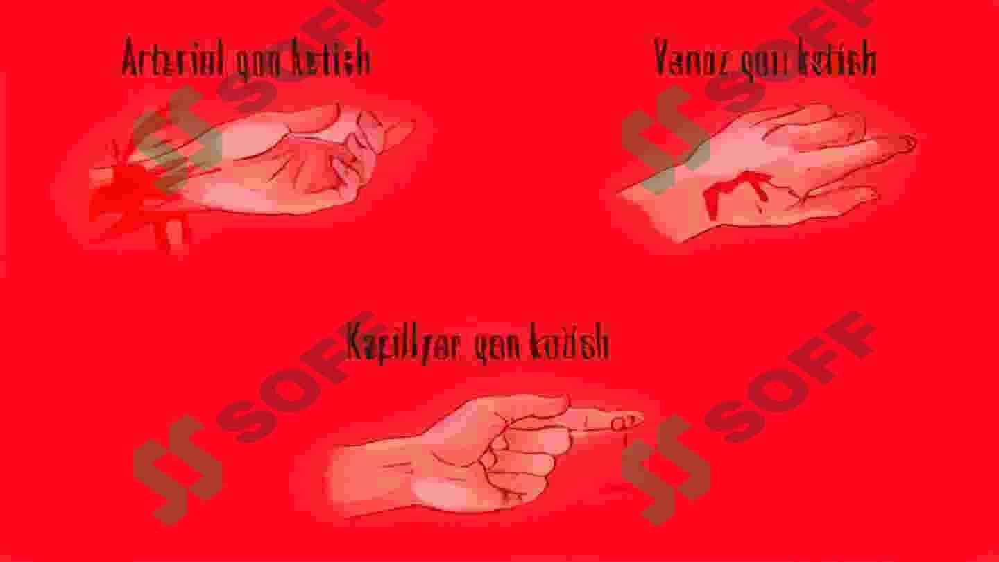 QON KETISH TURLARI VA UNI TO'XTATISH USULLARI 4
