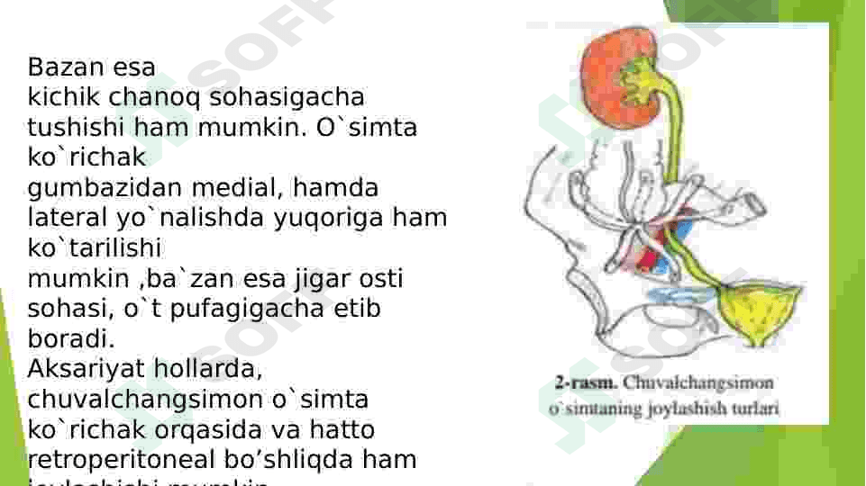 Oʻtkir apendisitni klinikasi 6
