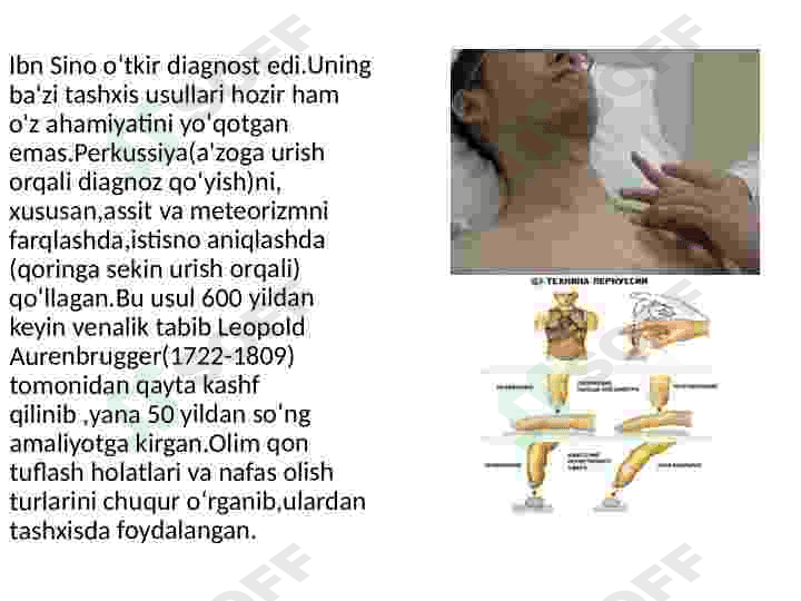 Ibn Sino taʼlimotida umumiy davolash usullari 6