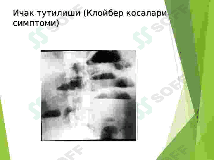 Ошкозон-ичак касалликларининг нур ташхиси 6