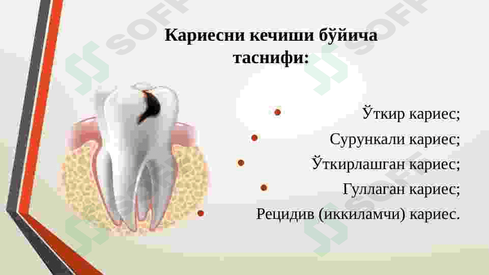 KARIES KASALLIGINI UMUMIY DAVOLASH 7