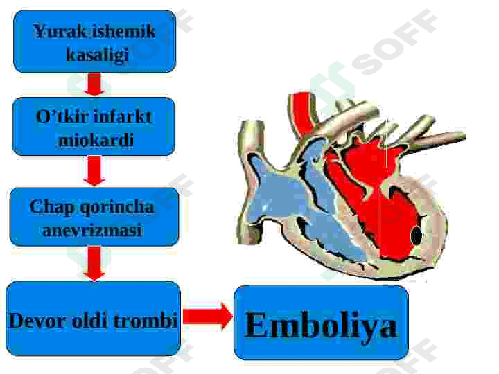 O‘TKIR ARTERIAL,TROMBOZ VA EMBOLIYALAR 8