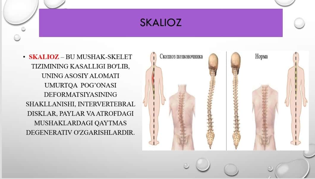 Skalioz kasalligi, tashxislash va kasallikni davolash usullari 1