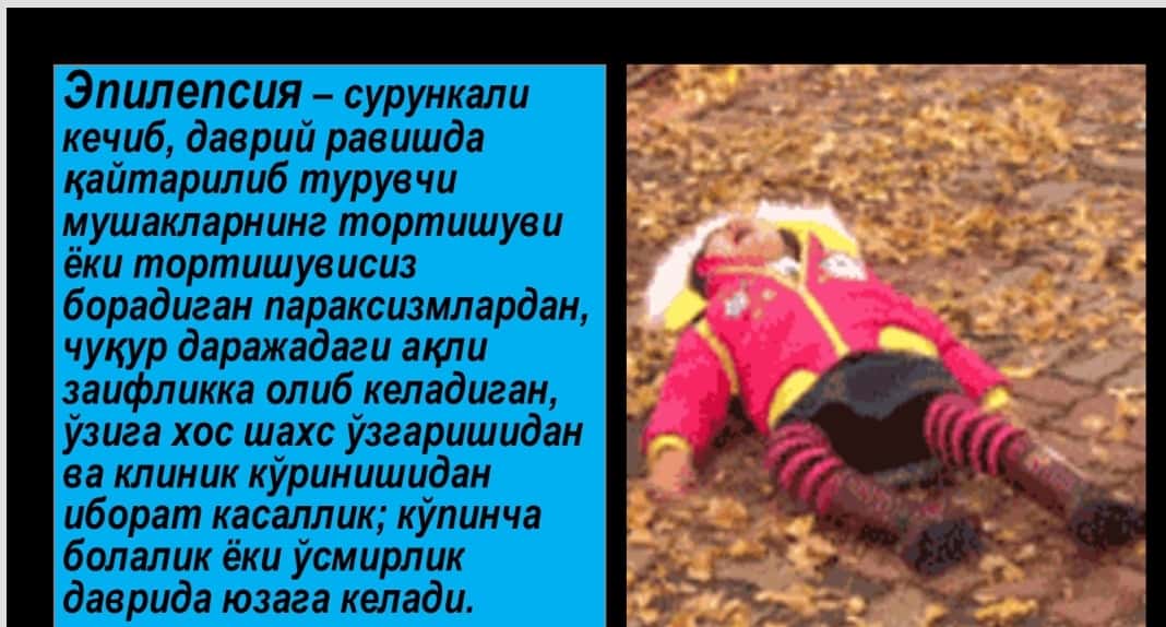 Nevrologiya . Epilepsiya kasalligi . Эпилепсия касаллиги 1
