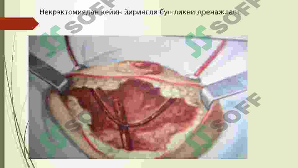 Jinsiy siklining gormonal boshqarilishi 8