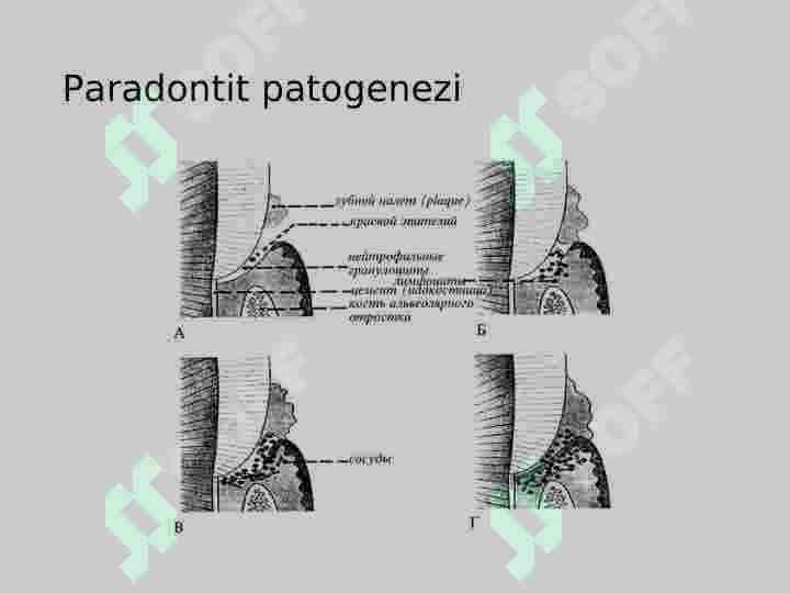 Paradont kasalliklari nur tashxisi 7