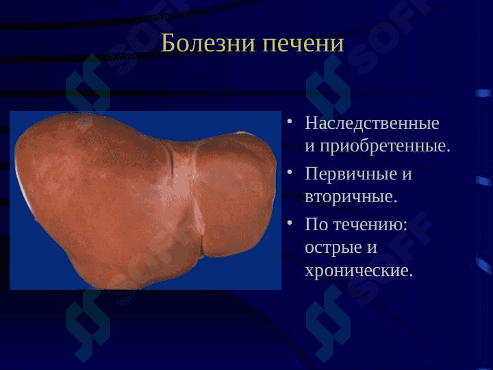 Болезни печени  Цирроз иопухоли печени 5