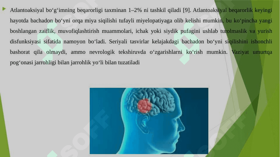 Daun sindromi 8