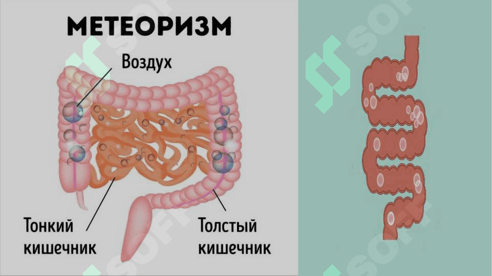 Disbakterioz va disbakteriozning zamonaviy bakteriologik diagnostikasi 6