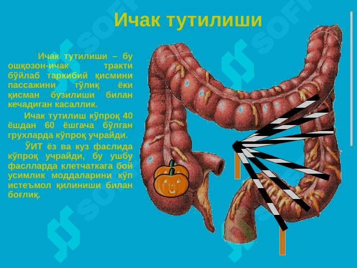 O'tkir ichak tutulishi ppt 2