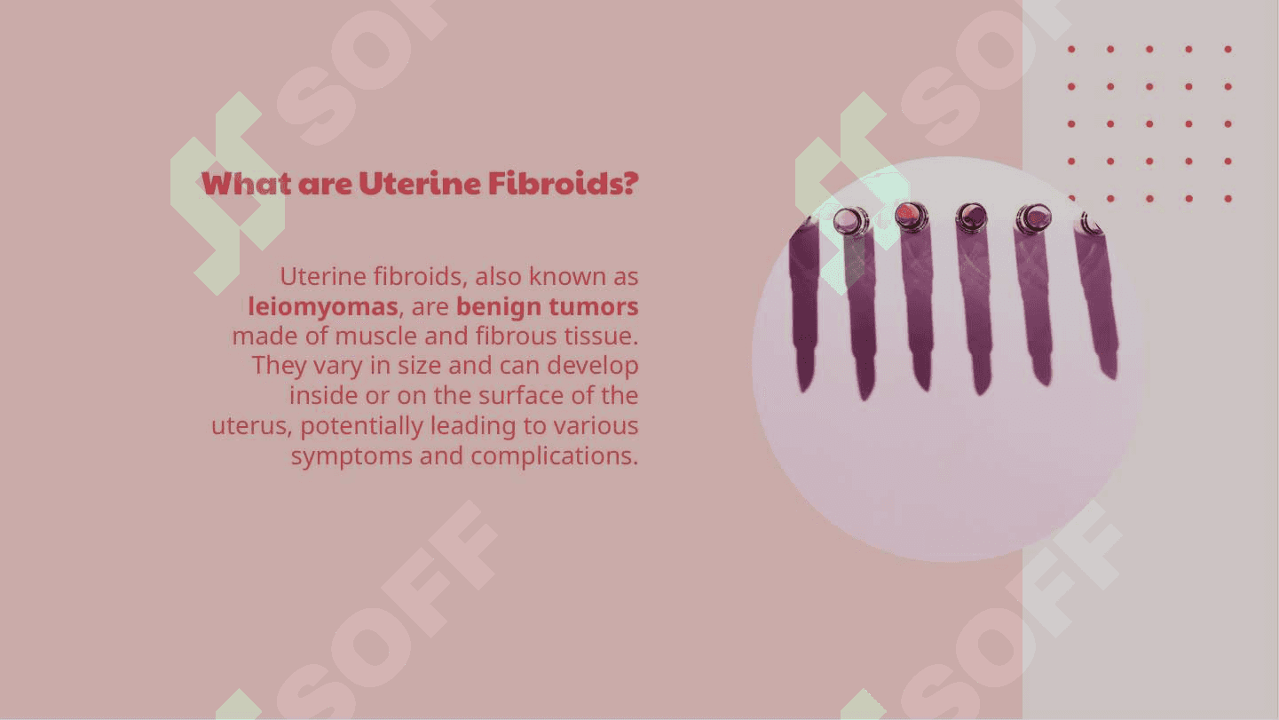 Uterine fibroids 4