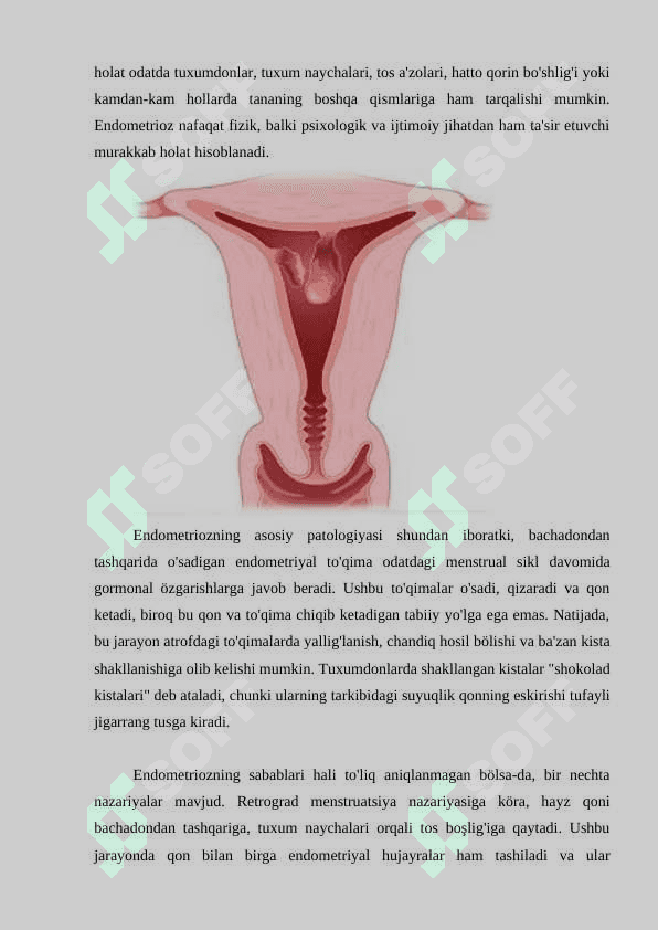 ENDOMETRIOZ 4
