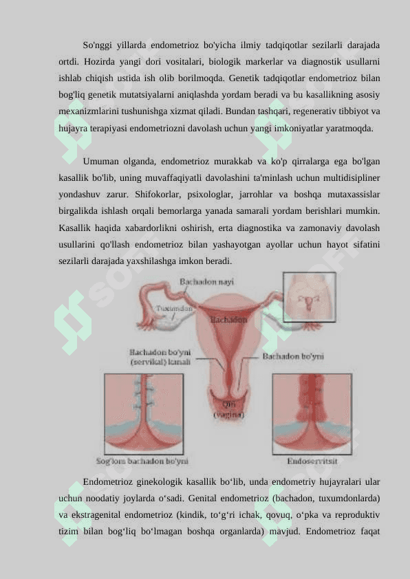 ENDOMETRIOZ 7