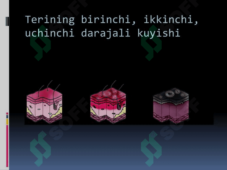Kombustiologiya asoslari 6