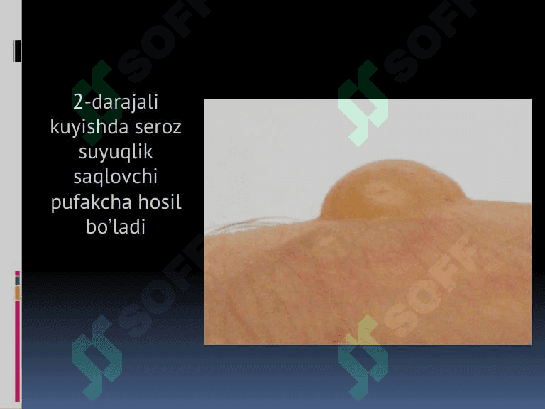 Kombustiologiya asoslari 7