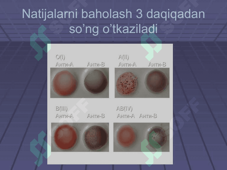Transfuziologiya asoslari 7