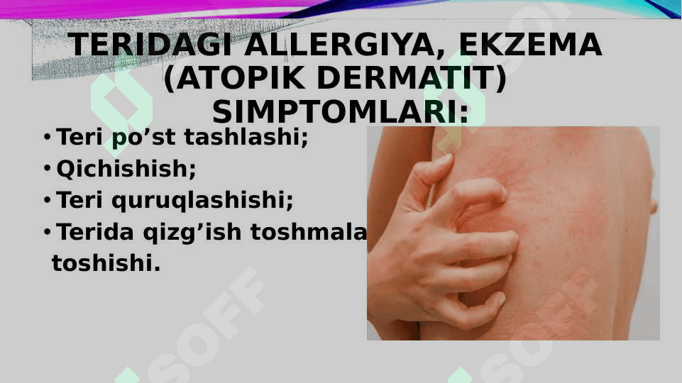 ALLERGIYA 7