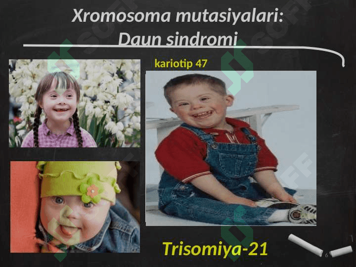 Odamda uchraydigan irsiy kasalliklar 6
