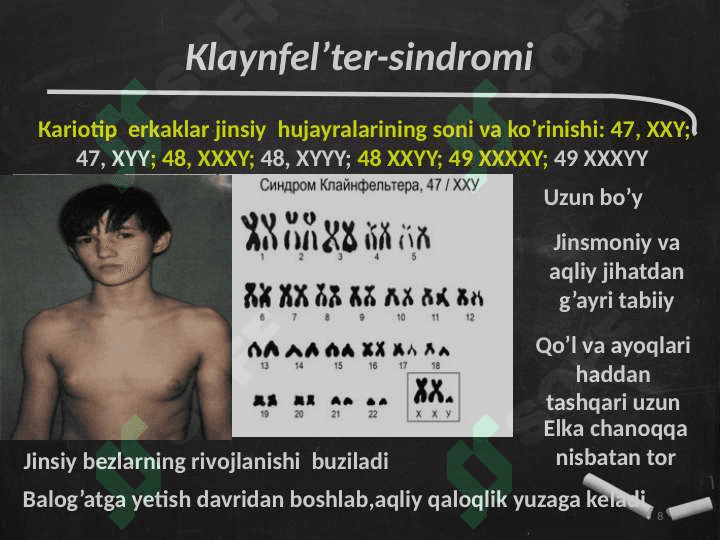 Odamda uchraydigan irsiy kasalliklar 8