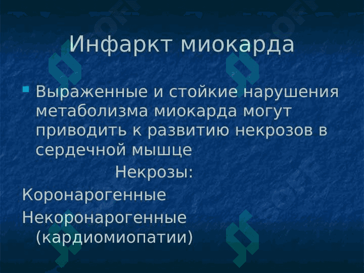 Инфаркт миокарда 2