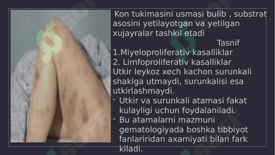 Surunkali leykozlar 2