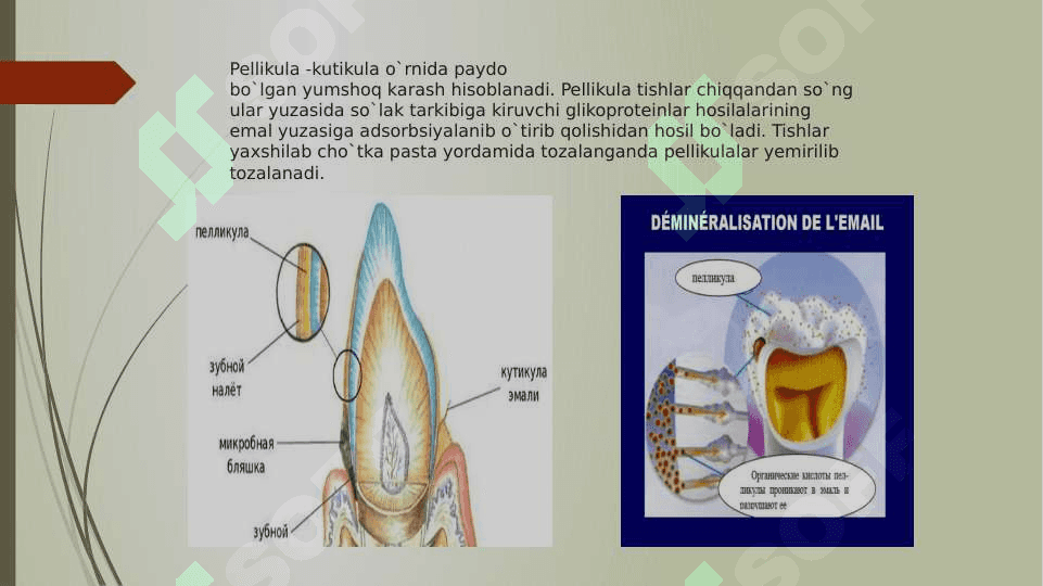 Tish yuzasida xosil bo’ladigan karashlar va toshlar 7