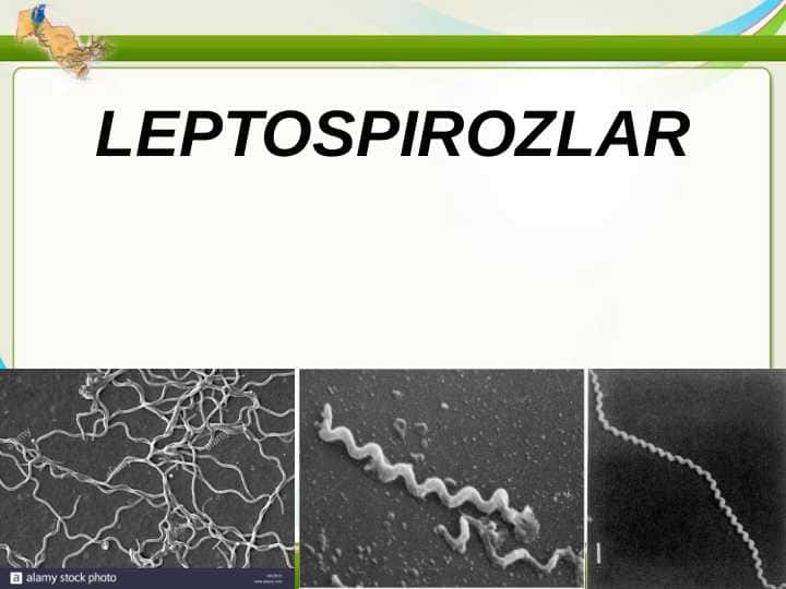 LEPTOSPIROZLAR. GEMORRAGIK ISITMA QO'ZG'ATUVCHILARI, PATOGENEZI, LABORATORIYA TASHHISI. LEPTOSPIROZLAR MORFOLOGIYASI, STRUKTURASI, TARQALGANLIGI, KELTIRIB CHIQARUVCHI KASALLIKLARI VA LABORATORIYA TASHHISI.