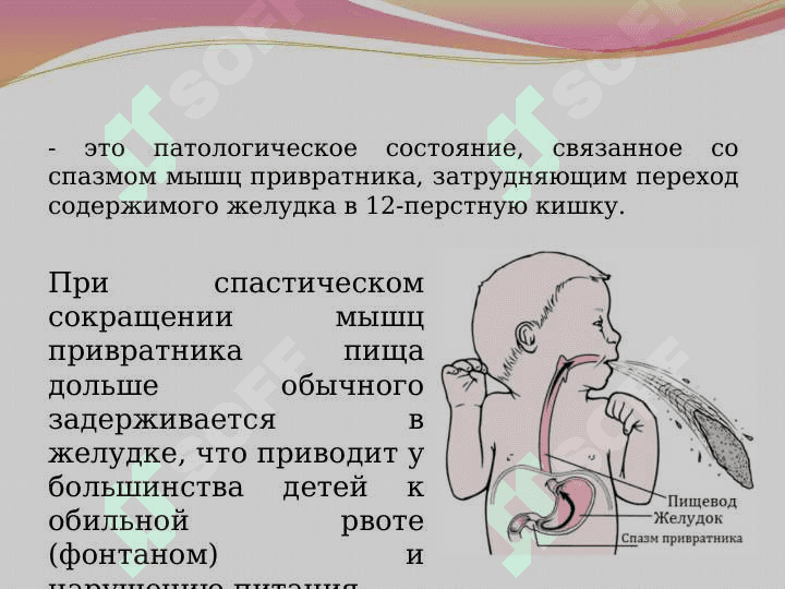 Пилороспазм у детей 4