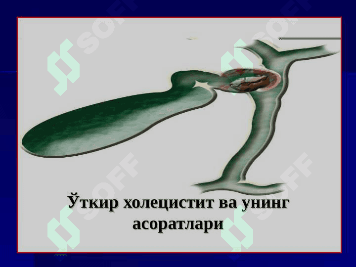 O'tkir xotesistit 2