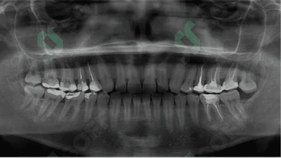 Zamonaviy rentgen tashxislash usullari 4