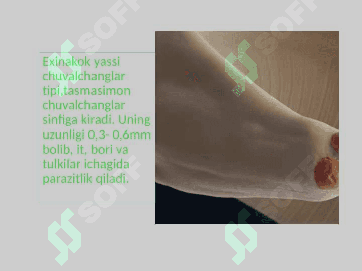 Parazit chuvalchanglarning xilma- xilligi 3