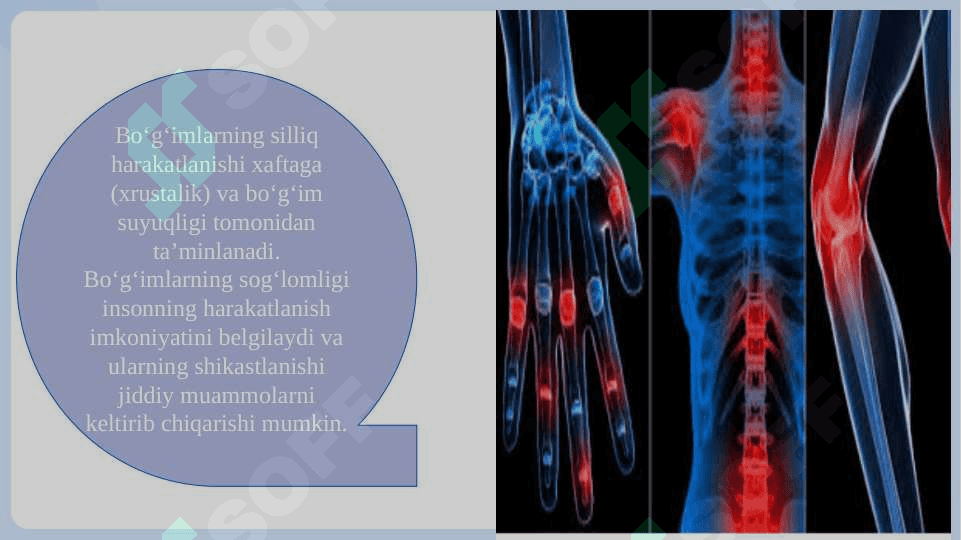 Tayanch- Harakat tizimi kasaliklari SLAYD 7