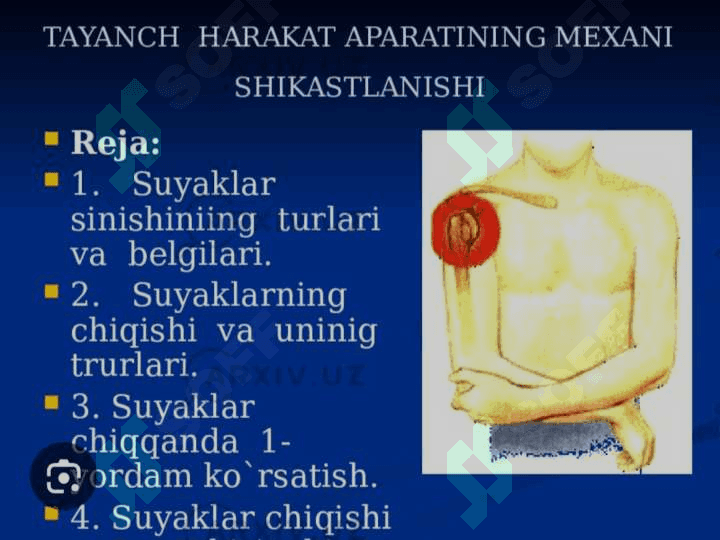 Tayanch harakatlanish kasalliklari haqida tushuncha 3