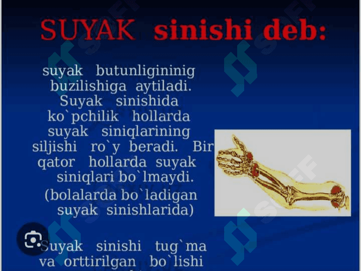 Tayanch harakatlanish kasalliklari haqida tushuncha 4