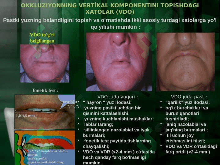 Markaziy okklyuziyani aniqlashda xatoliklar 7