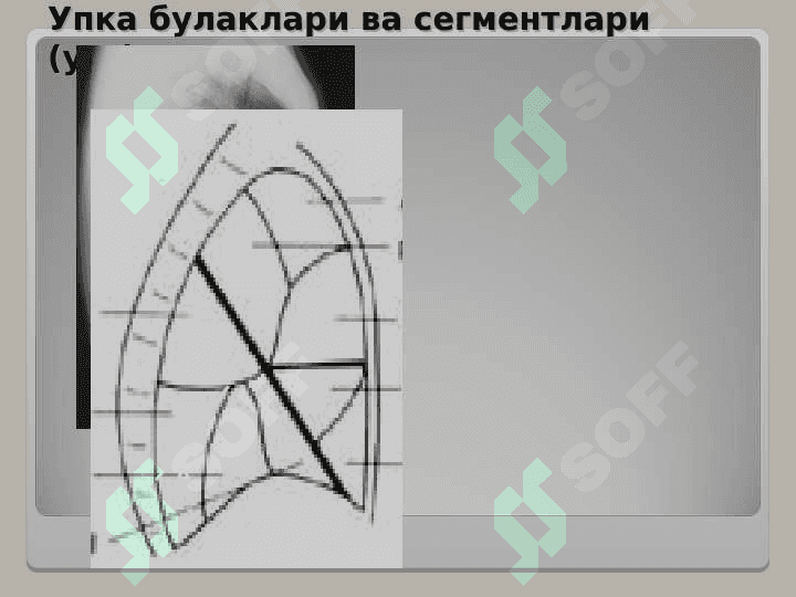 Nafas aʼzolari kasalliklarini tekshirishda magnit rezonans tomografiyaning ahamiyati 2
