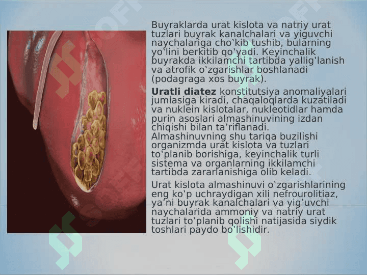 Tosh kasalliklarining kimyoviy asoslari 6