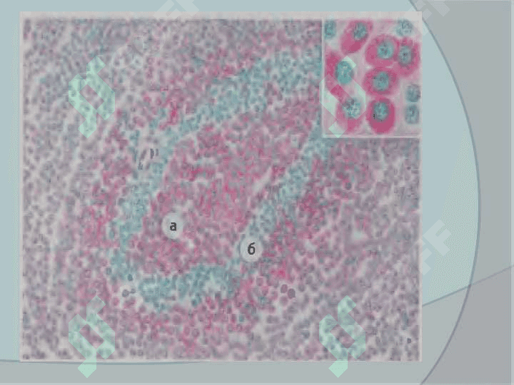 Immunopatalogik jarayonlar.immunogenez buzilish morfologiyasi 8