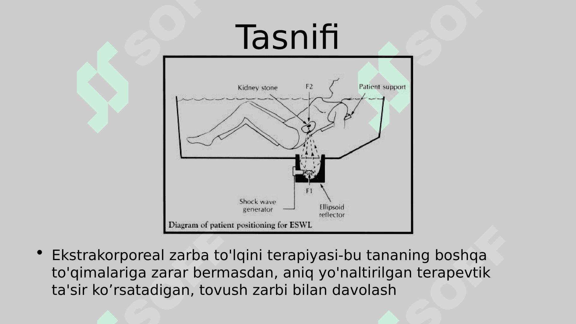 Ekstrokorporal zarb to’lqinli litotripsiya 2