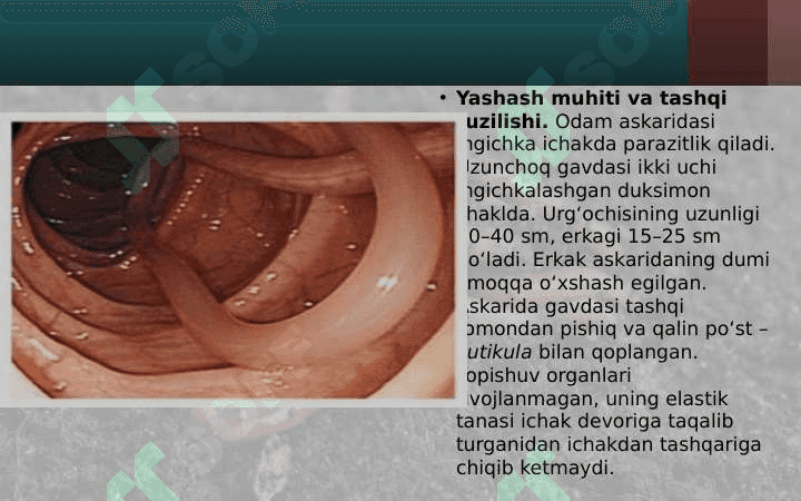 To‘garak chuvalchanglar tipi. odam askaridasi 3
