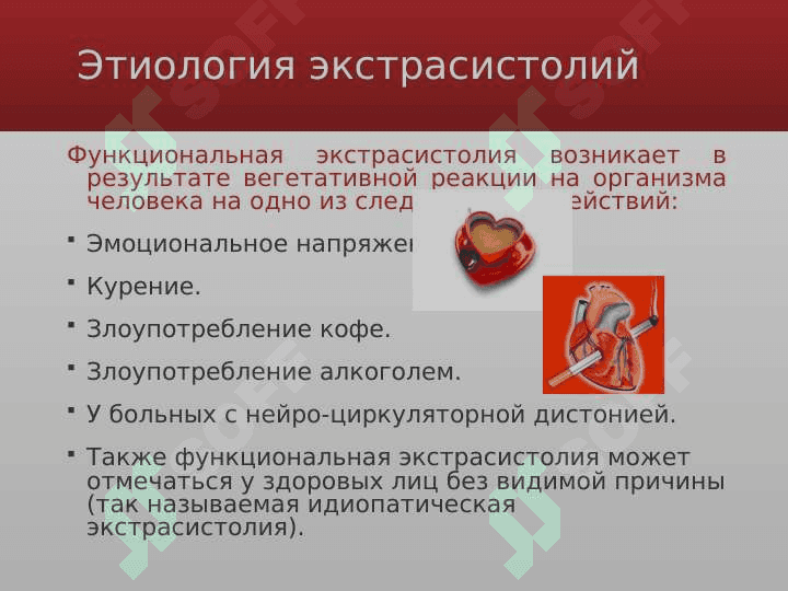 Ekistrasistola (rus) ppt 6