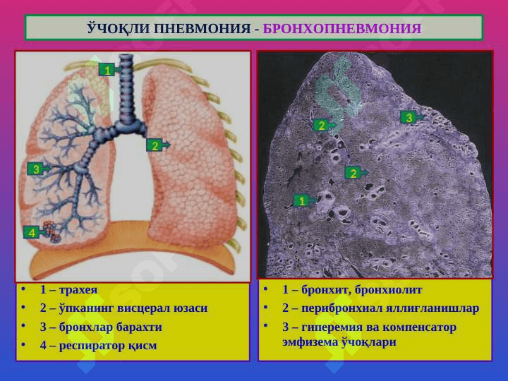 Ўпка касалликлари 5