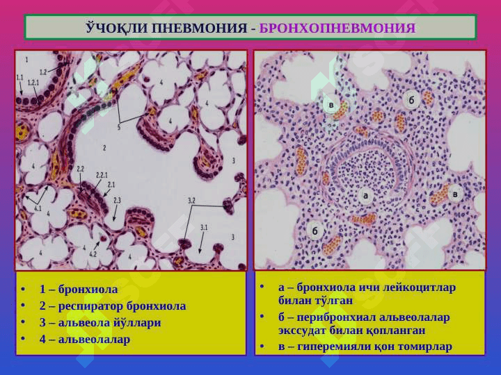 Ўпка касалликлари 6