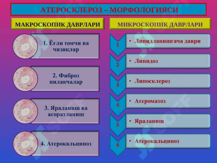 Атеросклероз. Гипертония касаллиги 5