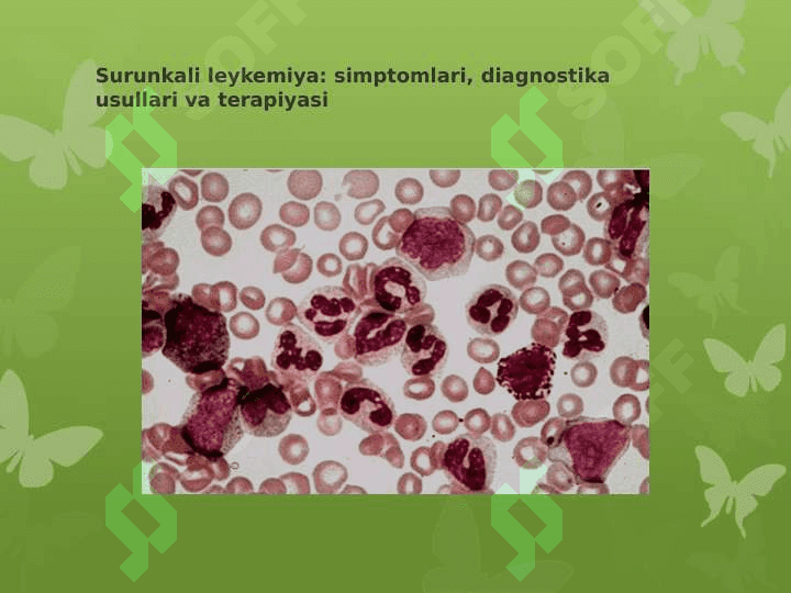 SURUNKALI LEYKOZLAR 2